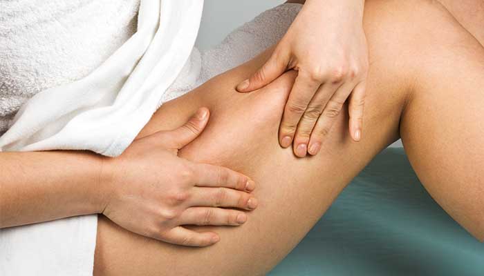 Cellulite : comprendre et agir naturellement