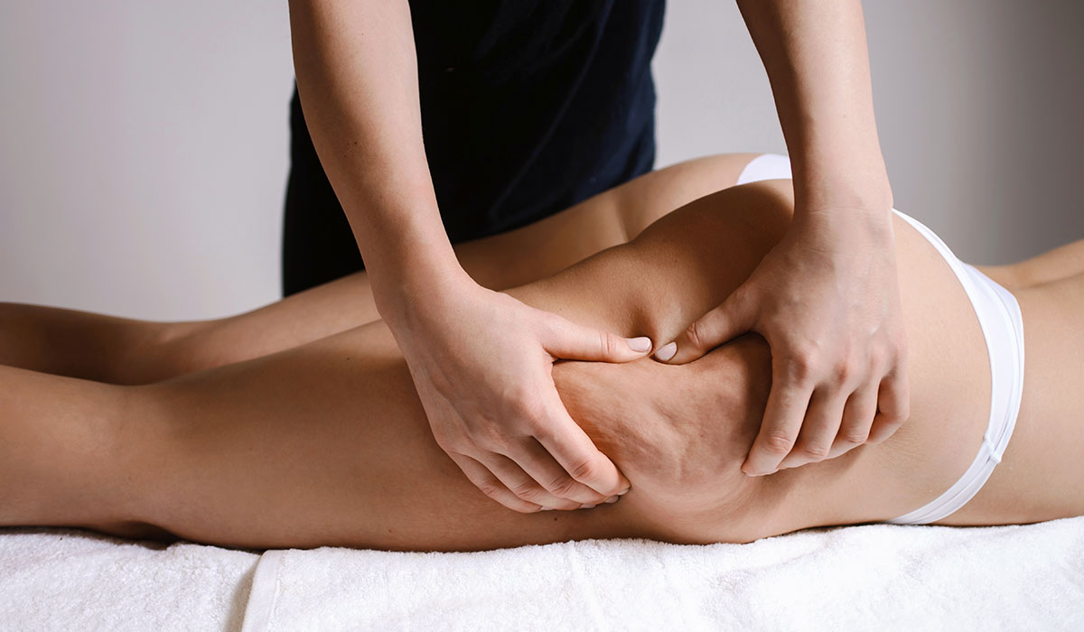 Massage anti-cellulite : les traitements efficaces 