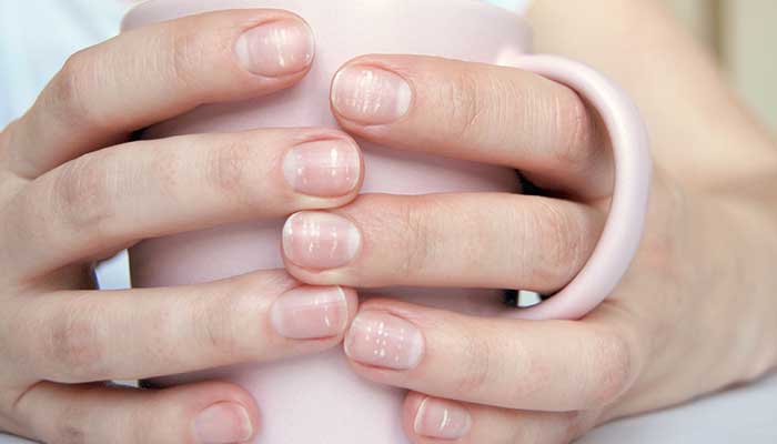 Que signifient les taches blanches sur les ongles ?