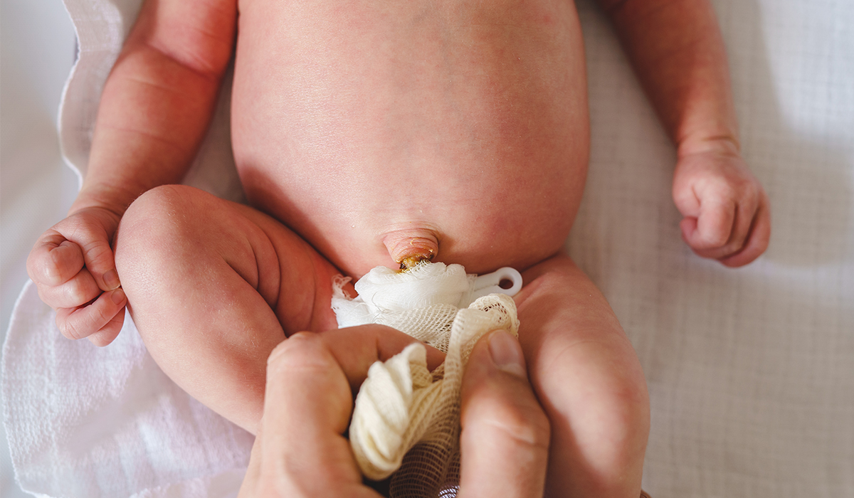 Bébé : quels sont les soins du cordon ombilical ?