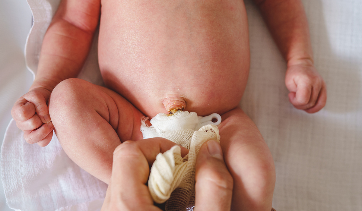 Bébé : quels sont les soins du cordon ombilical ? | La Vie Naturelle